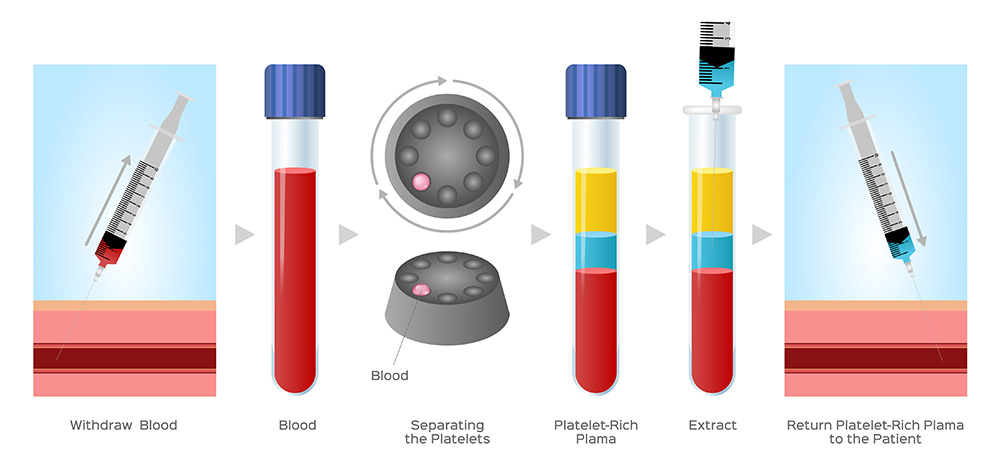 A diagram of blood and plasma in tubes.