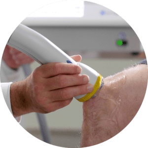 Shockwave Therapy in North Charleston