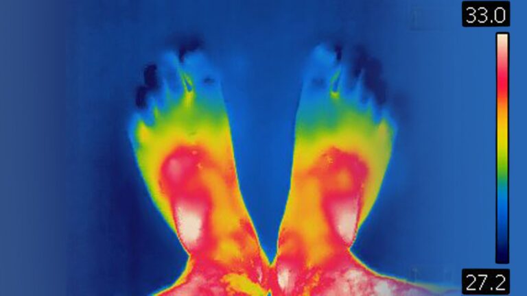 Heat-Map Body Scan at Charleston Pain Relief Center, North Charleston SC