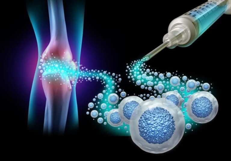 Healing Cell Therapy at Charleston Pain Relief Center, North Charleston SC