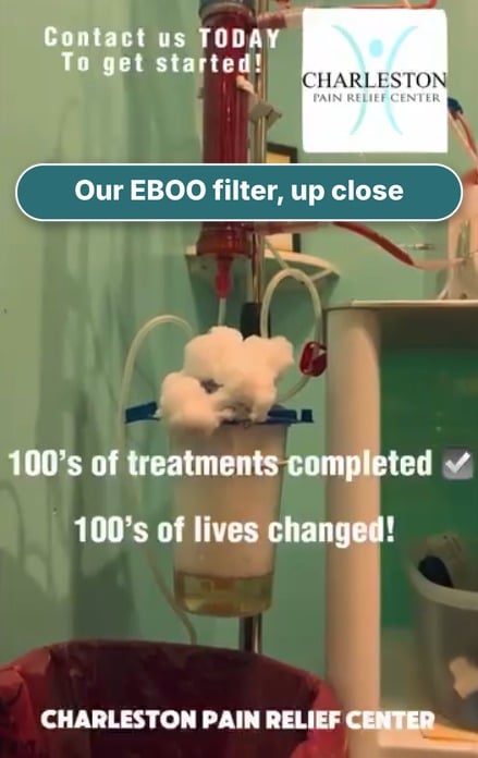 The EBOO filter during a treatment at Charleston Pain Relief Center in North Charleston, SC